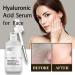 Hyaluronic Acid 2% + B5 & Alpha Arbutin 2% + Hyaluronic Acid Skincare Serum Set Face Serum for Women & Men Dark Spot Remover for Face Face Moisturizer Set to Plump and Smooth Skin for All Skin Types - Buy Online on GoSupps.com