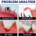Toothache Sprays - 0.7 Fl Oz. - Buy Online on GoSupps.com