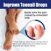 Ingrown Toenail Treatment - 30ML Ingrown Toenail Correction Drops - Nail Helper Ingrowth Toenail Treatment Oil - Trimming Toenail Softening Drops - Nail Fungal Treatment - Buy Online on GoSupps.com