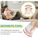 Soft Silicone Hammer Toe Corrector - Relieve Fatigue with 3 Pairs Toe Separator - Buy Online on GoSupps.com