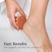 Scrubbies Pumice Stone for Feet - 5+ Year Lasting Foot Exfoliator & Callus Remover | Natural Terra-Cotta Flower - Buy Online on GoSupps.com