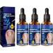 Huile de paronychia allemande pour enlever la paronychia traitement des ongles des pieds meilleure solution de r paration des ongles liquide de renouvellement des ongles endommag s (3 pi ces) 3 pi ces.