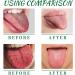 Portable Tongue Repair Spray - Relieve Bad Breath Swelling & Pain | Pack of 3 - pH Neutral & Effective Cleaning - Buy Online on GoSupps.com