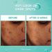 L'Or al Paris Bright Reveal Dark Spot Face Serum with 12% Niacinamide + Ferulic + Amino Sulfonic Acids Reduces the Look of Stubborn Dark Spots For All Skin Tones Skincare 30mL - Buy Online on GoSupps.com
