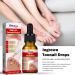 Ingrown Toenail Treatment Ingrowing Toenail Treatment Nail Growth Treatment Natural Ingrown Toenail Correction Nail Treatments Trimming Toenail Softening Drops Toe Nail Fungal Treatment(10ml) - Buy Online on GoSupps.com