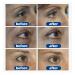 Jasmine Ointment Plus - Eye Cream for Dark Circles Corns & Loops | Collagen & Aloe Vera | 100ml - 3 Pack - Buy Online on GoSupps.com