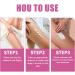 Cr me Dissolvant de Boutons pour les Fesses Cr me pour les Boutons des Fesses Lotion de Compensation de l'acn 100ml - Buy Online on GoSupps.com