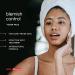 Buy BioMiracle Blemish Control Toner Pads - Effective Spot Treatment Mild Exfoliation & Soothing Formula (90 Pads) - International Shipping Available - Buy Online on GoSupps.com