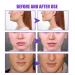 Face Firming Cream - V-Shape Slimming & Advanced Skin Tightening for Loose Sagging Skin - Buy Online on GoSupps.com
