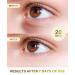 Dr. Pure Under Eye Patches (30 Pairs) - Eye Masks for Dark Circles, Puffy Eyes & Puffiness with 24K Gold - Under Eye Patches for Dark Circles and Puffiness - Buy Online on GoSupps.com
