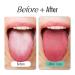 100% Stainless Steel Tongue Scraper | Wipe Tongue Fresh Oral Care | Pack of 2 Tongue Cleaners for Adults | Essential Oral Hygiene Tool - Buy Online on GoSupps.com