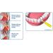 Piksters Interdental Brush Size 3 (40 Pack) - Best Interdental Cleaning for Healthy Teeth | International Shipping Available - Buy Online on GoSupps.com