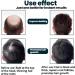 Serum Pousse Cheveux Anti Chute de Cheveux Homme Hair Growth Pousse Cheveux Tr s Rapide Favorise la Pousse des Cheveux Plus pais Hydrate Racines et R pare Cheveux Secs Fourchus et Cassants - Buy Online on GoSupps.com