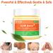 Heat Rash Cream  Eczema  Hand Foot Treat  Tinea Versicolor  Itchy Feet  Butt  Anal Itch  Psoriasis  Scalp Dandruff  Bee Sting  Bites  Boil Cyst  Armpit  Adults Kids  Hidradenitis Suppurativa Treat - Buy Online on GoSupps.com