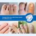 Anti Fungal Nail Treatment Device Anti Fungal Laser Nail Fungus Laser Treatment for Damaged Discolored Thick Toenails & Fingernails 7-Minute Home Treatment for Hand Toenail Fungal Infections - Buy Online on GoSupps.com