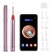 Ear Wax Removal 3.9mm Ear Otoscope 6 LED Lights Ear Cleaner Tool Wireless Connected Waterproof Compatible with iOS Android Smart Phones & Tablets for Adults Kids & Pets-Rose Gold