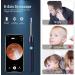 Podero Ear Wax Removal Kit with 1080P Camera - Ear Cleaner for iPhone, iPad, Android Phones - Black - Buy Online on GoSupps.com