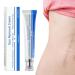 Scar gel Cream against stretch marks 30g Care Gel For Burns Injuries Keloid Surgical Face Neck Hands Body All Types of Scars