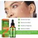 Kojic Acid Face Serum 30ml- Papaya Serum for Face - Dark Spot Remover Face Oil - Face Care Serum for Women - Face Essence for Moisturization Anti-Aging Wrinkles - Buy Online on GoSupps.com