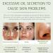 Effective Acne Treatment Face Cream | Herbal Spot Treatment for Teens & Adults | Remove Acne Marks & Moisturize Skin - Buy Online on GoSupps.com