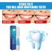 Teeth Whitening Pen Set - 5 PCs | Instant Gum Treatment Gel | Safe Tartar Removal & Brightening for Adults - Buy Online on GoSupps.com