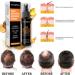 Trendyfave Hair Regrowth Spray Hair Growth Serum Thickening Hair Volume Spray Anti Hair Loss Spray Hair Rapid Growth Spray Natural Ingredients Hair Regrowth Serum Repair Hair Follicles -30ML - Buy Online on GoSupps.com
