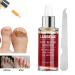 Nail Repair Essence 12ml - Natural Anti-fungus Treatment for Effective Nail Repair - Buy Online on GoSupps.com