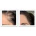 Buy Caboki 10X Volumizing Hair Powder - Dark Brown | Talc-Free Root Touch Up for Thinning Hair Covers Bald Spots & Gray for Men & Women - Buy Online on GoSupps.com