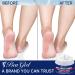 Urea Cream 40% for Intensive Foot Repair & Callus Remover - Softens and Moisturizes Dry Cracked Feet - Buy Online on GoSupps.com