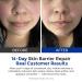 Hyaluronic Acid Repair Serum for Calming Barrier Repair Redness Reilef, for Sensitive Skin +4D Hyaluronic Acid Serum with VB5, Ceramides, Anti-Aging Hydrating for Moisturizing Barrier Daily face Care - Buy Online on GoSupps.com