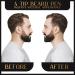 BARDAE Beard Pencil Filler for Men - Long Lasting Water and Sweat Proof Beard Pen - Instant Natural Look - 4 Tip Applicator Design - Black - Buy Online on GoSupps.com