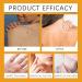 2pc Zoencgz New Bee Venom Repair Cream 60g Natural Hydrating Moisturizing Treatment Cream for Men&Women - Buy Online on GoSupps.com