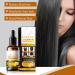 Natural Hair Regrowth - Hair Loss Treatment Volume & Root Booster 30ml Moisturizing Hair Treatment for Stronger Hair Plus Anloximt - Buy Online on GoSupps.com