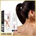 Vitiligo Removal Relief Spray - Reduces White Spots on Skin - 3pcs - Buy Online on GoSupps.com