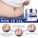 Advanced Scar Removal Cream - Effective Treatment for Surgical Acne C-Section Burns & Stretch Marks - Old & New Scars - Buy Online on GoSupps.com