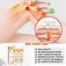 Buy New Bee Venom Gel - Herbal Honey Joint Cream for Pain Relief | International Shipping - Buy Online on GoSupps.com
