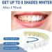 Teeth Whitening Pen & Gel - Intensive Stain Remover for Whiter Teeth (2pcs) - Fast International Shipping - Buy Online on GoSupps.com