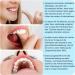 Myospots - Flavorful Tongue Training Tablets (100 pcs) for Better Breathing & Health - Versatile Support for Oral Wellness - Buy Online on GoSupps.com