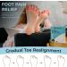 Toe Spreader Silicone for Overlapping Toes - 4 Pieces (Single Loop & Full Foot) | Correct Bunion & Restore Toe Shape | Pink - Buy Online on GoSupps.com