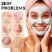 Amazonian White Clay Refreshing Pore Mask | Blackhead Remover & Resurfacing Treatment | 200ml for Flawless Skin - International Shipping Available - Buy Online on GoSupps.com