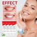 SP-6 Probiotic Whitening Toothpaste | Ultra Whitening & Deep Cleaning Care for Fresh Breath - Buy Online on GoSupps.com