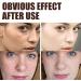 Anti-Wrinkle Face & Neck Retinol Cream with Hyaluronic Acid - Premium Anti-Aging Face Moisturizer - Anti Aging Firming Facial Cream to Reduce Wrinkles Dark Spots Fine Lines Sun Damage - Buy Online on GoSupps.com