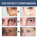 Men's 6-in-1 Face Moisturizer Cream for Eye Bags - Anti-Aging & Dark Spot Treatment - 2x50ml (2 Pack) - Buy Online on GoSupps.com