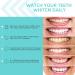 FUREIN SMILE Teeth Whitening Strips - 14 Treatments, Hydrogen Peroxide, Vegan Stain Remover, Mint Flavor - Buy Online on GoSupps.com
