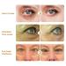 ABERA Natural Repair Eye Cream - Set of 2 | Reduces Under Eye Bags Puffiness Wrinkles & Dark Circles | 0.5 fl oz Each | International Shipping Available - Buy Online on GoSupps.com