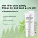 Anti Acne Face Cream Tea Tree Acne Cream for Acne Treatment & Spot Treatment Spot Cream Soothing Ance Gel for Blemishes Blackhead Remover Acne Moisturiser Reduces Redness Oil Control - Buy Online on GoSupps.com