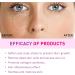 Milia Removal Face Serums Milia Spot Remover Milia Remover Milia Spot Serum for Face Milia Serum for Face Milia Spot Serum Helps to Ruduce Milia Reduces Bags Saggy Skin & Puffy Eyes 30ML - Buy Online on GoSupps.com