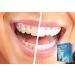 Whitelabs At Home Professional Teeth Whitening Kit | Best Results for Bright Smiles Worldwide - Buy Online on GoSupps.com