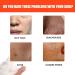 Nettoyant Visage La Roche Volcanique For Hommes: Nettoyage En Profondeur Des Pores Contr le Du S bum limination Points Noirs Soulagement De L'acn Hydratant Et Rafra chissant(3PCS) - Buy Online on GoSupps.com