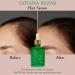Vegan Hair Serum for Women & Men - Boost Growth & Prevent Hair Loss - Rosemary & Amla Hair Vitamins - 1 Fl Oz - Buy Online on GoSupps.com